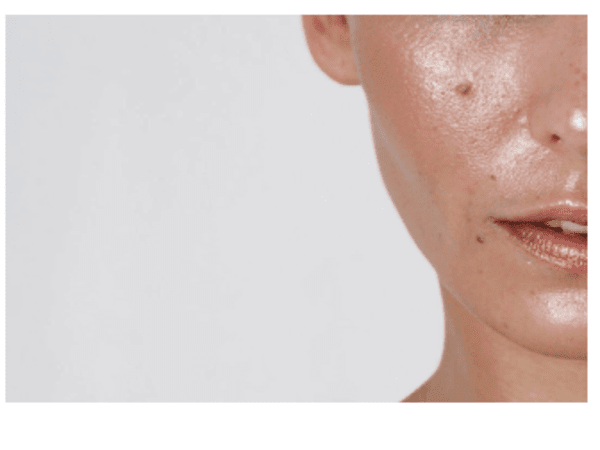 oily skin के लिए क्या करना चाहिए